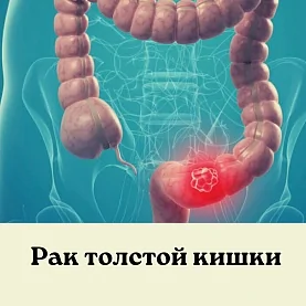 Колоноскопия - метод эндоскопической диагностики заболеваний толстой кишки